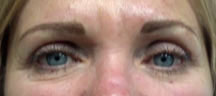 Permanent Eyebrows