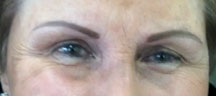 Permanent Eyebrows