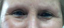 Permanent Eyebrows