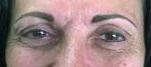 Permanent Eyebrows