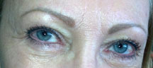 Permanent Eyebrows