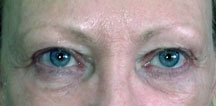 Permanent Eyebrows