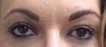 Permanent Eyebrows