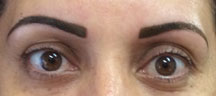 Brows