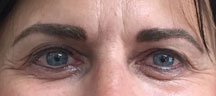 Permanent Eyebrows