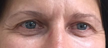Permanent Eyebrows
