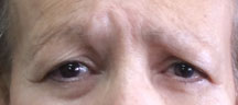 Permanent Eyebrows