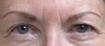 Permanent Eyebrows