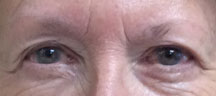 Permanent Eyebrows