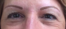 Permanent Eyebrows