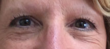 Permanent Eyebrows