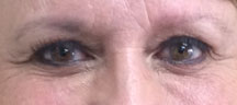 Permanent Eyebrows