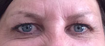 Permanent Eyebrows