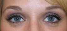 eyelinercamlyn1860healed