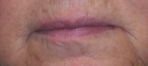 Lipliner0408Before