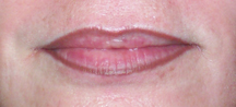 Lipliner1602after