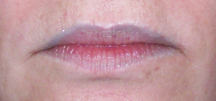 Lipliner1602Before