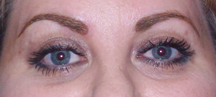 Brows1674after
